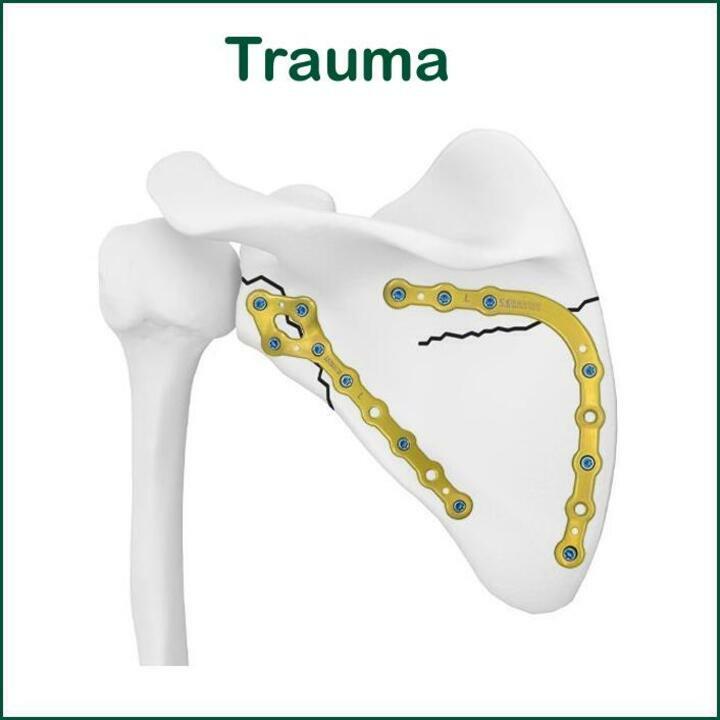 Trauma