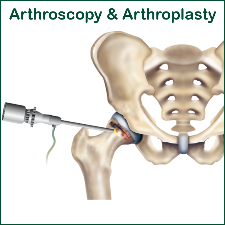 Arthroscopy 